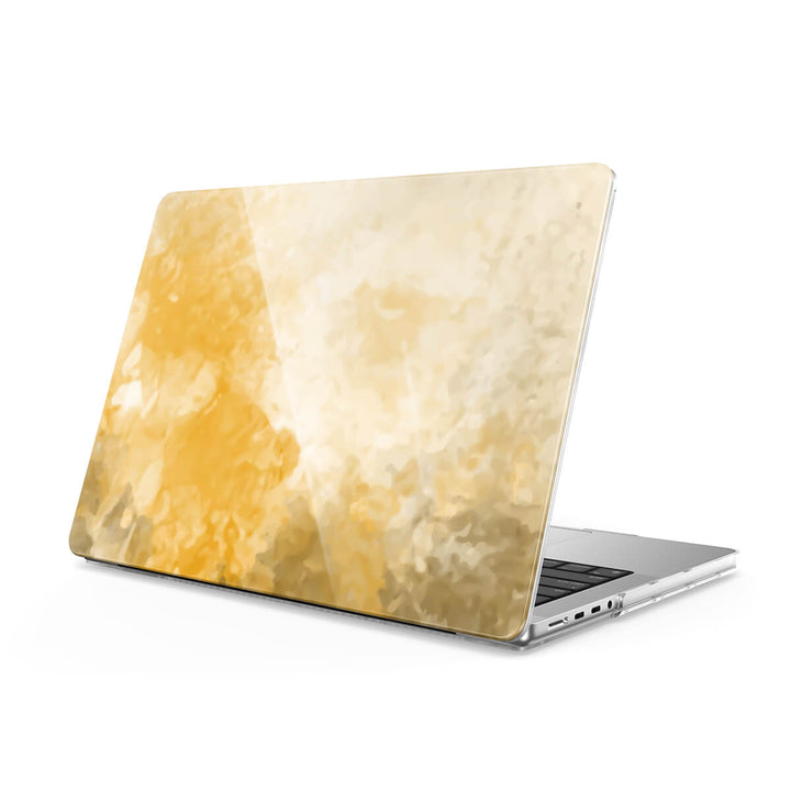 Autumn Forest | Macbook Anti-Fall Protective Case